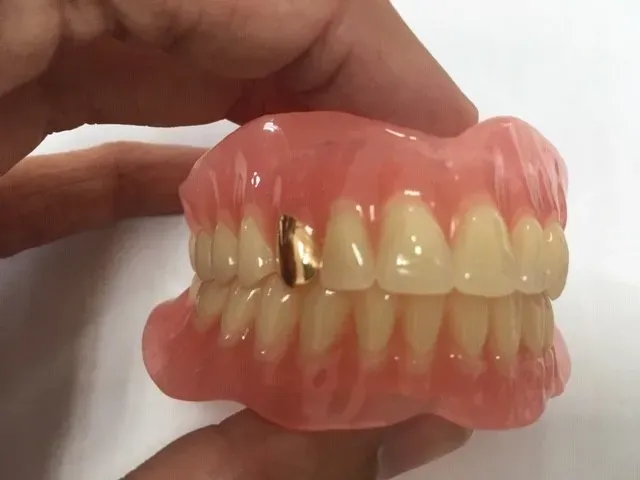 dentier près de Saint-André